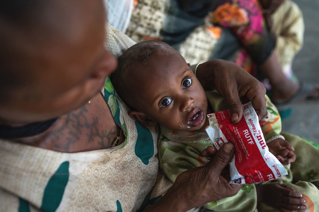 طفل يبلغ من العمر عام واحد يعالج من سوء التغذية في مركز صحي في منطقة تيغراي بشمال إثيوبيا.