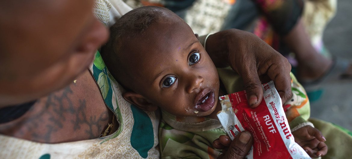 A one-year-old lad  is treated for malnutrition astatine  a wellness  centre successful  the Tigray portion   of bluish   Ethiopia.