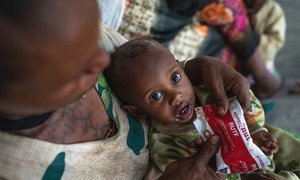 在埃塞俄比亚北部提格雷地区的一个保健中心，一名一岁男孩因营养不良接受治疗。