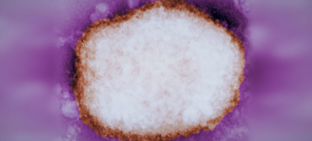 Vue au microscope d'une particule du virus de la variole du singe, retrouvée dans le liquide d'une cloque sur la peau d'un sujet humain.