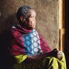 埃塞俄比亚首都亚的斯亚贝巴的一名麻风患者。