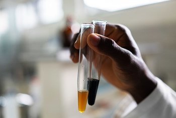 घाना की एक प्रयोगशाला में एक शोधकर्ता, पौधों से प्राप्त अर्क़ की जाँच करते हुए.