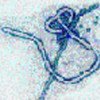 Ebola virus