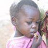 Malnourished child in Chiphwanya Village, Malawi