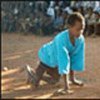 11 year old Somali boy, paralysed by polio