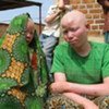 Albino children in Tanzania