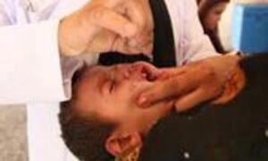 A boy gets his two drops of oral polio vaccine in Afghanistan
