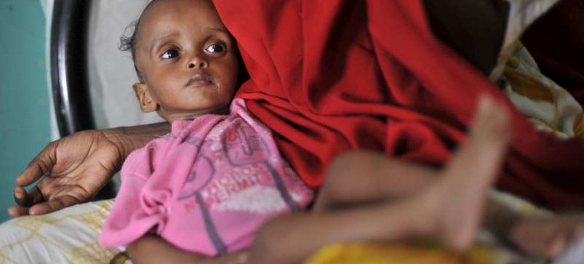 This young Somali was suffering from severe malnutrition after fleeing home with his parents