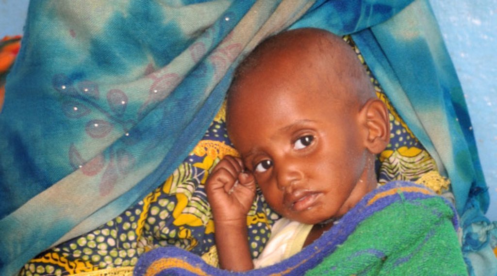萨赫勒地区，一位母亲与她患有严重营养不良的孩子。