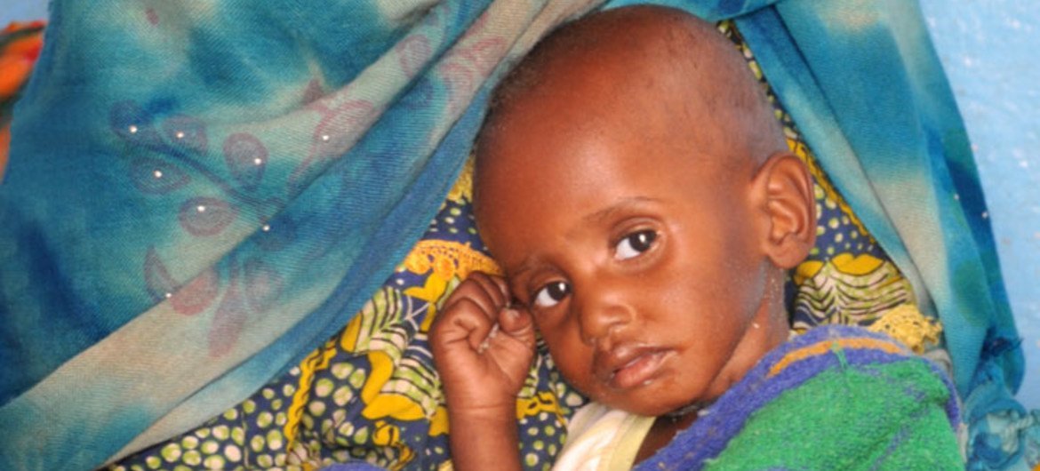 A mother with her severely malnourished child in the Sahel region.