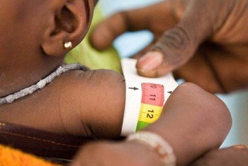 A child gets measured for malnutrition in Mali.