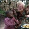 An albino woman in Tanzania who was brutally attacked due to rumors about their magical powers (file photo).