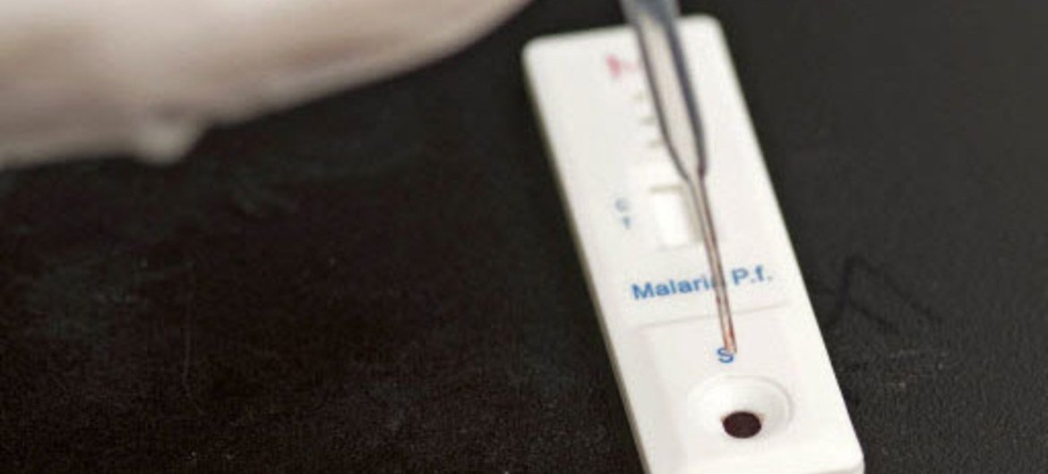 Prueba de sangre para detectar la presencia del virus de la malaria. Foto de archivo: OMS/TDR/Simon Lim