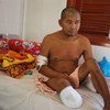 Un homme cambodgien de 46 ans a perdu sa jambe en raison du diabète. Les maladies non transmissibles (MNT) causent chaque année 15 millions de décès.