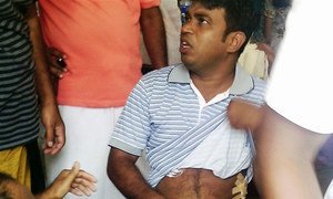 A man injured in communal violence between Muslims and Buddhists in Sri Lanka.
