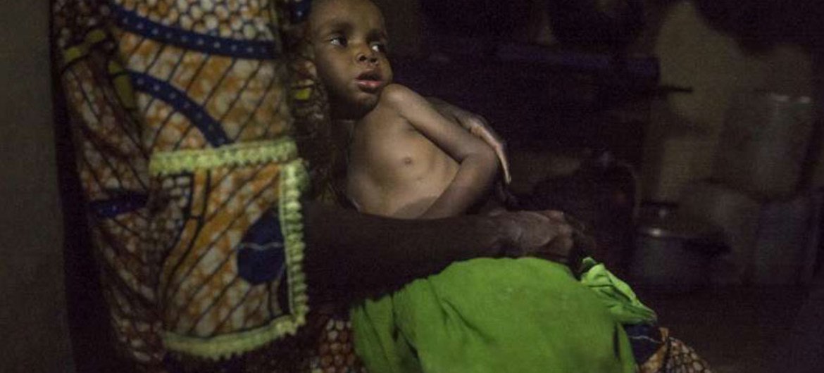Severely malnourished refugee child from the Central African Republic at a feeding centre in Batouri hospital, Cameroon.
