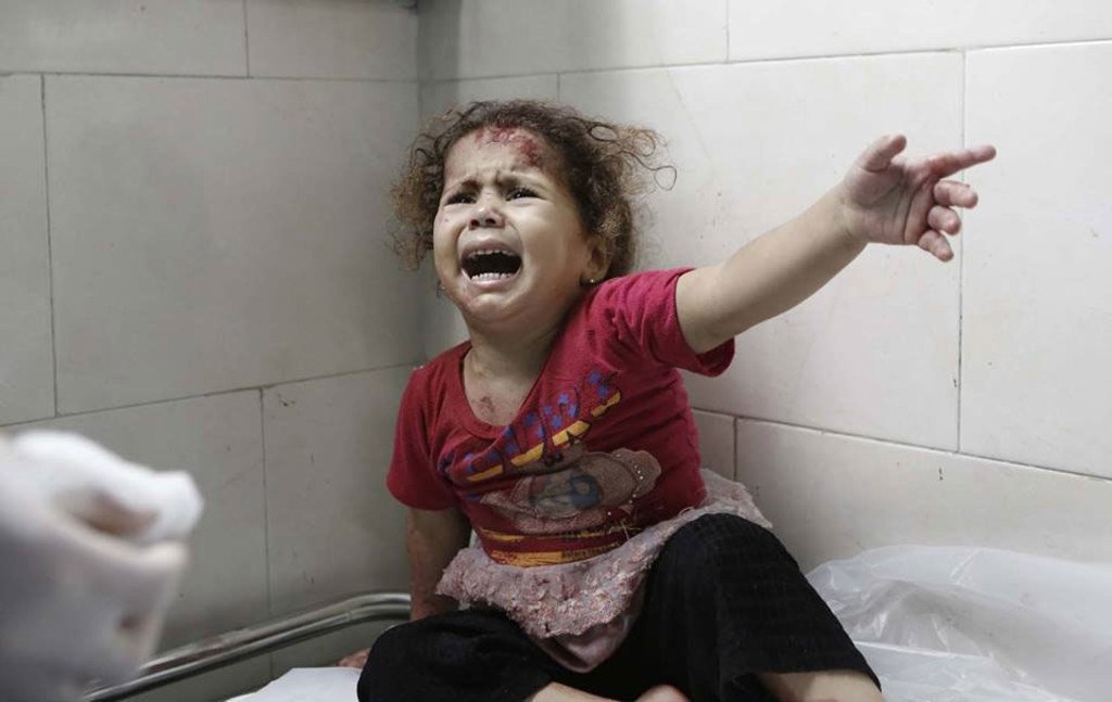 (Maktaba) Mtoto akilia wakati mhudumu wa afya akimsogelea kutibu jeraha lake, Ni katika hospitali ya Al-Shifa mjini Gaza
