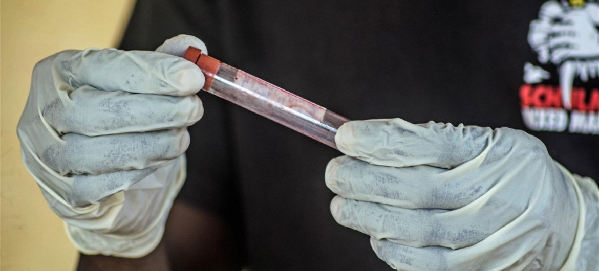 Un trabajador sanitario manipula una muestra de sangre para determinar posible contagio de ébola  Foto: IRIN/Tommy Trenchard