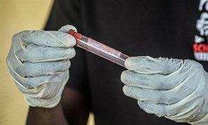 A health worker checks a blood sample for Ebola at Kenema government hospital, Sierra Leone.