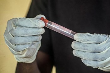 A health worker checks a blood sample for Ebola at Kenema government hospital, Sierra Leone.
