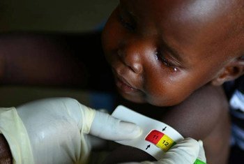 La couleur rouge signifie danger. Des dizaines de milliers d'enfants de moins de 5 ans risquent de mourir à cause de la malnutrition au Soudan du Sud. Photo UNICEF/Christine Nesbitt