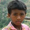 Un enfant malgache ayant survécu à la peste bubonique après avoir été infecté en 2011. (archives)