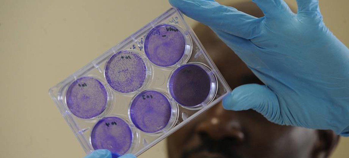 Un scientifique portant des gants bleus tient une boîte de Petri contenant des échantillons biologiques colorés en violet.