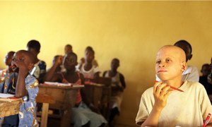 An Albino student (right) attends school in Niambly, near Duekoue, Côte d’Ivoire.