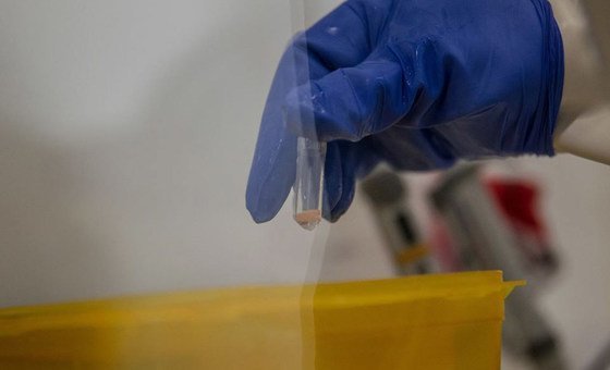 جمهورية الكونغو الديمقراطية تعلن ظهور الإيبولا بعد ثبوت حالتين مخبريا