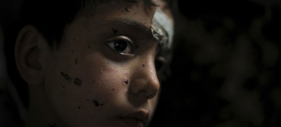叙利亚难民儿童。儿基会图片/Kate Brooks