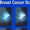 乳腺癌筛查。国际癌症研究机构图片