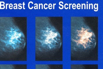 Рак груди