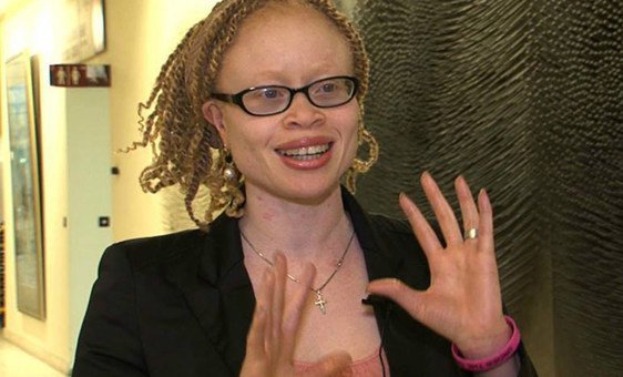 Ikponwosa Ero informou que deve reunir fatos sobre experiências de pessoas com albinismo e seus familiares.