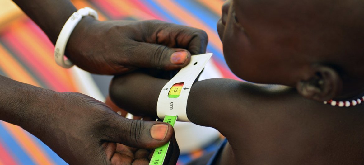 عامل في مجال الصحة، يقيس عضد صبي صغير لتقييم وضعه التغذوي قبل إدخاله مستشفى تدعمه اليونيسف في جوبا، جنوب السودان. المصدر: اليونيسف / كريستين نسبيت
