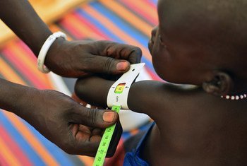 A health worker measures a baby girl’s arm, at an outpatient therapeutic feeding centre at the Protection of Civilians site on the UN peacekeeping mission in South Sudan (UNMISS) base in Malakal, capital of Upper Nile State.