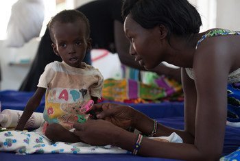 Two-year-old, Kuot is being treated for severe acute malnutrition, at the UNICEF-supported Al-Shabbah Children’s Hospital, in Juba, South Sudan.
