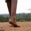 الآلاف من الأطفال في بوروندي مصابون بسوء التغذية الحاد بسبب التوترات في البلاد. صور اليونيسيف/Nijimbere