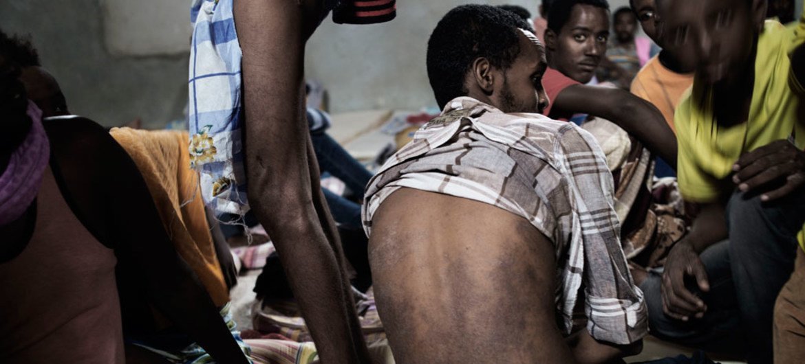在利比亚首都附近的一个拘留中心里，一位逃离厄立特里亚的男子的背上伤痕累累。