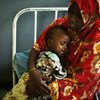 A mother cradles her malnourished and dehydrated baby at Banadir Hospital in the Somali capital Mogadishu 2011.