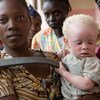 Une femme tient dans ses bras un enfant atteint d'albinisme à Goma, en République démocratique du Congo, en 2007. Photo ONU/Marie Frechon