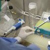 Un investigador de la Fundación Oswaldo Cruz en Pernambuco, Brasil, realiza un test de diagnóstico para determinar la presencia del virus del zika en muestras de sangre de mujeres embarazadas que habían reportado picores. Foto: OPS/OMS