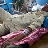 一名接受依赖治疗的缅甸吸毒者。毒品与犯罪问题办公室