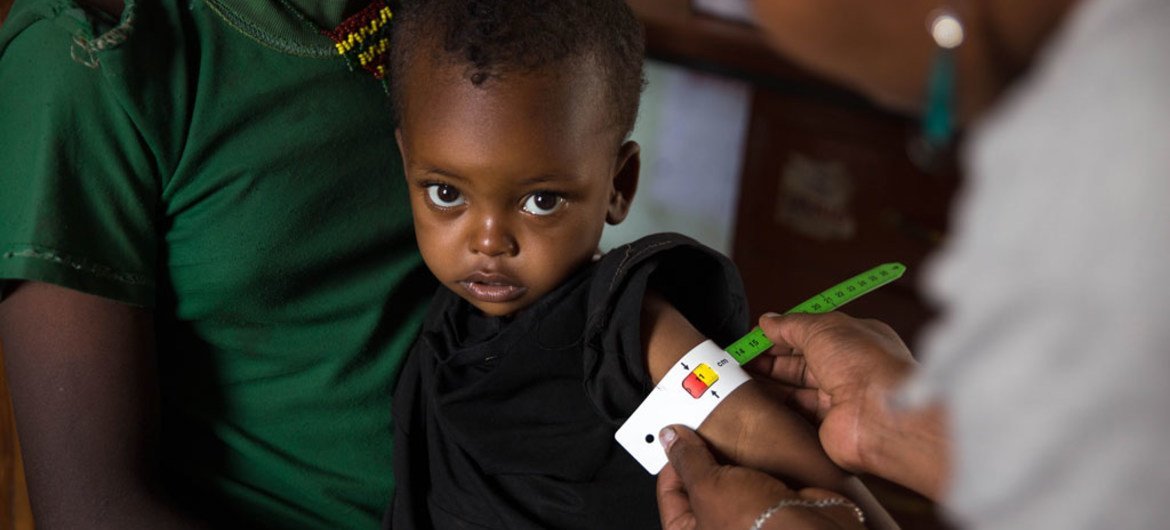 En Ethiopie, un agent de santé mesure le tour de bras de Nébila, 28 mois, qui a été diagnostiquée comme souffrant de malnutrition aiguë sévère. Photo : UNICEF / UN022074 / Ayene