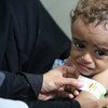 也门一个名叫艾哈迈德的三岁男孩在医院接受中度急性营养不良治疗。粮食署图片/Abeer Etefa