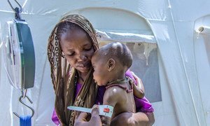 An 11-month-old child having his arm cirmeasured at a health centre at the Banki IDP camp in Borno state, northeast Nigeria.