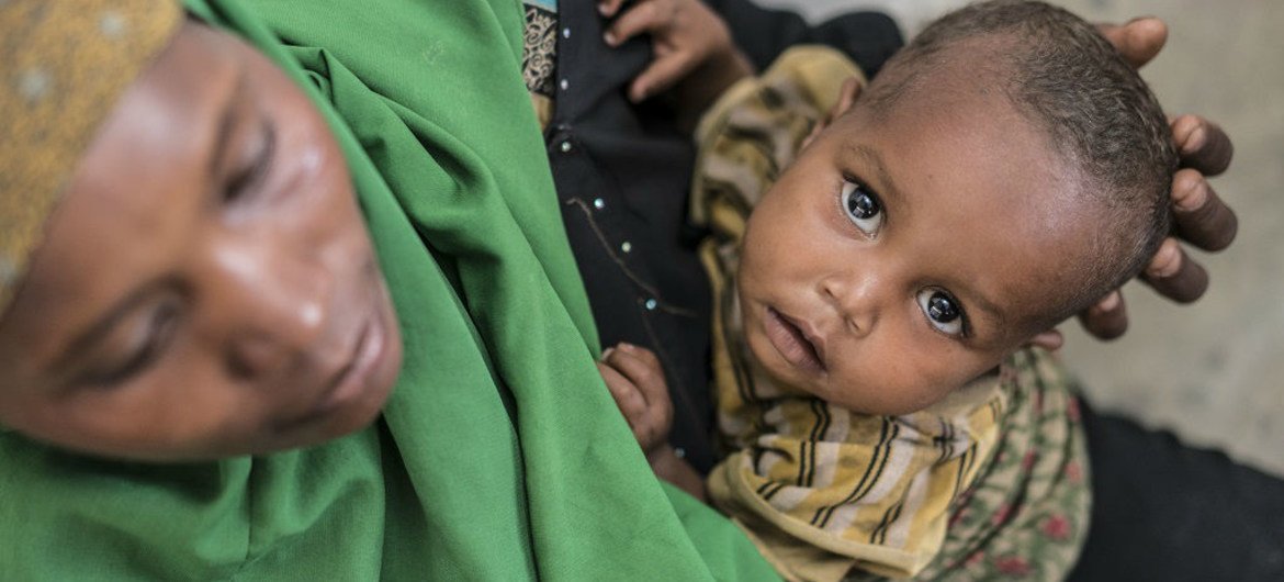 A young boy suffering from malnutrition is held by his mother at a UNICEF-supported Outpatient Therapeutic Program (OTP) in Baidoa, Somalia.