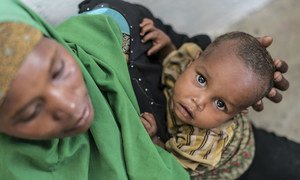 A young boy suffering from malnutrition is held by his mother at a UNICEF-supported Outpatient Therapeutic Program (OTP) in Baidoa, Somalia.