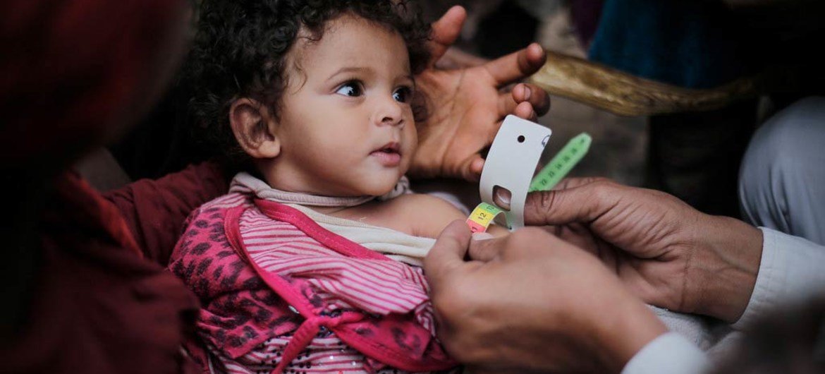 医生正在对也门萨那一名患有急性营养不良的儿童进行筛查。