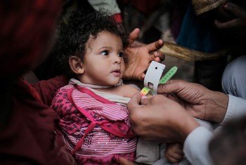 Un enfant souffrant de malnutrition aiguë fait l'objet d'un dépistage par un médecin, à Sanaa, au Yémen. Photo UNICEF/Almang