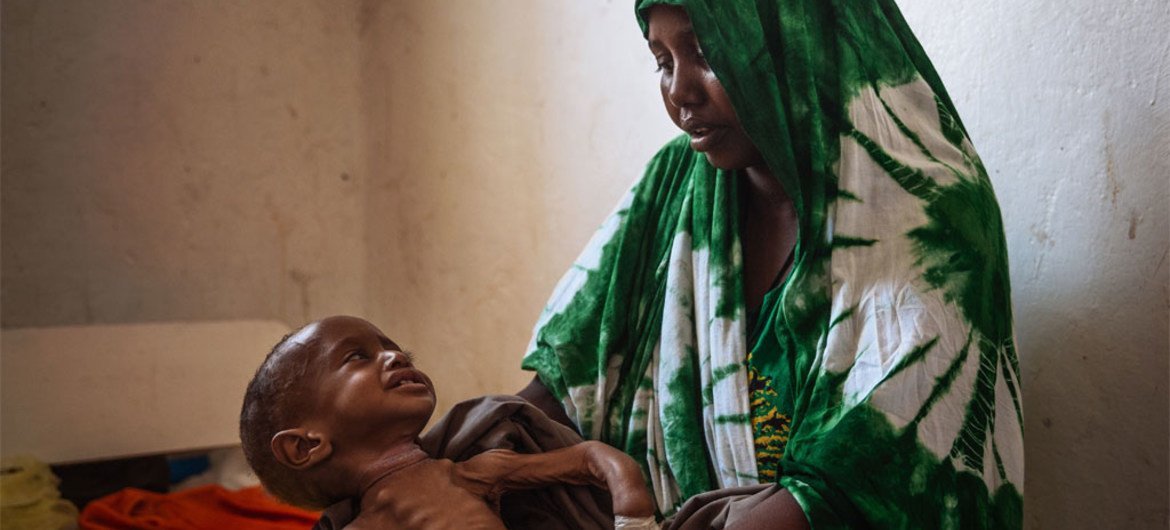 A two year-old child cries for his mother at the Kismayo general hospital in Somalia. Born with a deformity, the child is also suffering from extreme malnourishment.
